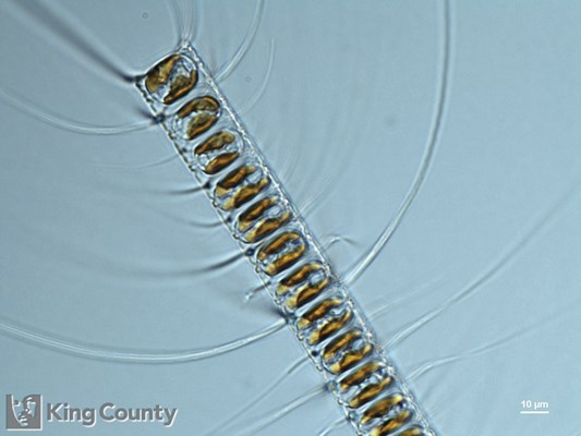 Photo of Chaetoceros vanheurckii